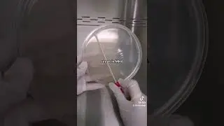 Antibiotics for Urinary Tract Infection. Anti-microbial Susceptibility Testing # #bacteria #medtech