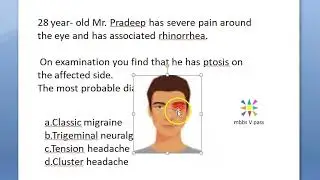 Medicine CLUSTER HEADACHE male eye pain orbital autonomic ptosis mcq