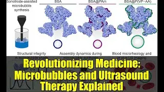 Revolutionizing Medicine: Microbubbles and Ultrasound Therapy Explained