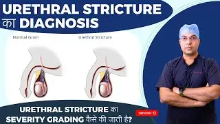 Urethral Stricture का Diagnosis और Severity Grading कैसे की जाती है?