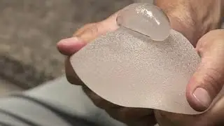 PIP breast implants: Only French victims can claim compensation from insurance company, rules ECJ