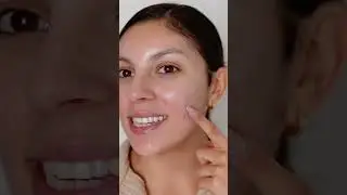 How to INSTANTLY hide acne with makeup