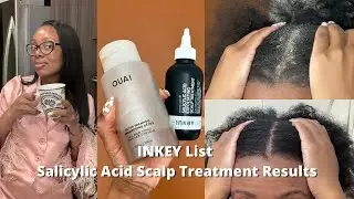 INKEY List Salycylic Acid Scalp Treatment Results