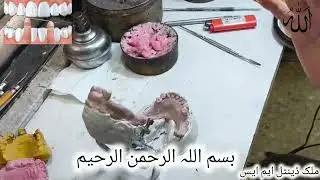 Dentistry working model Dancher uper lower Wax up 🦷