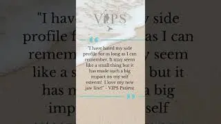 Amazing Results - Juvederm Volux Jaw Filler