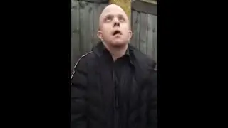 Bald nonce full sting
