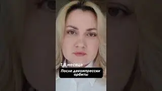 Результат декомпрессии орбиты