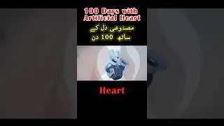 100 Days with Artificial Heart | مصنوعی دل کے ساتھ 100 دن