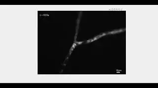 Rhizophagus irregularis C2 hyphal network - lipids stained with Nile Red. AMF_VU