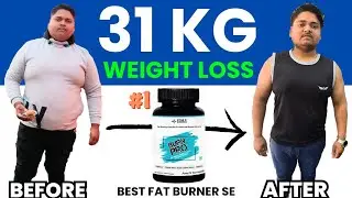 31 KG WEIGHT LOSS | star x Burn pro results | vajan kaise ghataye | vajan ghatao | supplements villa