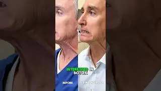Two Weeks After Neck Botox&hellip; WOW! (Dr. Ruff&rsquo;s Results) | West End Plastic Surgery
