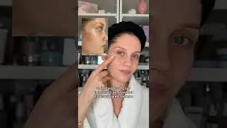 RETINOIDS 4 ACNE💗 #differin #tretinoin #adapalene #retinol #retinal #retinoids #acne #acnetreatment