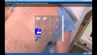 ECG simulation showcase