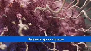 Medical Animations - Bacteria Gonorrhoea
