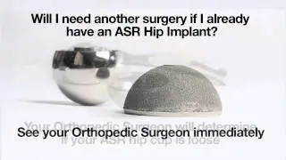 Q&A #2 DEPUY ASR HIP RECALL-Do I need another surgery?