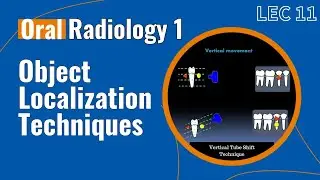 Oral Radiology 1 ; Lec 11 ; Object Localization Techniques.