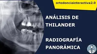 ANALÍSIS DE THILANDER EN ORTODONCIA