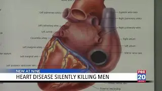 Heart disease: Why Alabama men can't ignore this silent killer