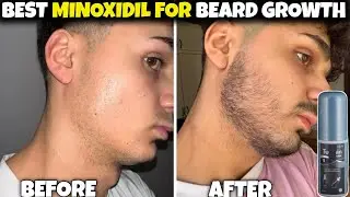 Can Tugain 5 Make You Grow Beard Faster? Real Test | Best Minoxidil For Beard Growth | Minoxidil 5