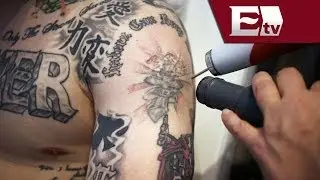 Cl&iacute;nica de Denver ayuda a exconvictos a reiniciar su vida removiendo tatuajes / Andrea Newman