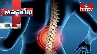 Solutions For Back Pain & Disk Problems | Homeocare International | Jeevana Rekha | hmtv