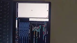 Complete StatefulWidget | SetState | Dispose | InitState | CreateState | State Management | Flutter