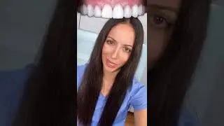 crowns vs veneers #shorts