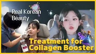 Fix Deep Smile Lines & Sunken Cheeks Naturally 💉 Real Korean Review