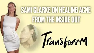 Sami Clarke on Healing Acne From the Inside Out