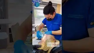 Zygomatic Dental Implants | Diamond Dental Antalya