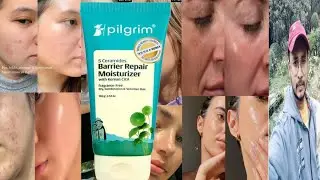 Pilgrim 5 Ceramides Barrier Repair Moisturizer | Honest Review