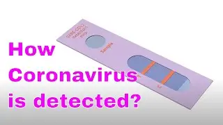 Fight COVID19 Animation :    How Coronavirus is Detected ?