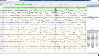 Live - Delta waves - relaxing sound to help you sleep and relax better