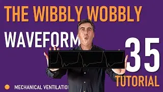 The Wibbly Wobbly Waveform (Expiratory Dysynchrony)