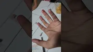#BDS 1st year #mini vlog 16 ...bleeding time test....physiology...