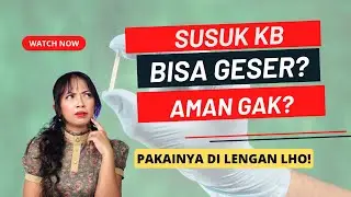 Efek samping KB implan atau susuk KB