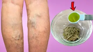 No doctor knows this, brew a bay leaf and get rid of varicose veins!