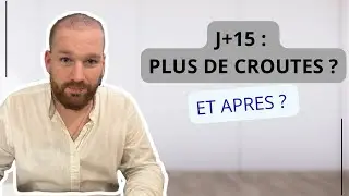 🔵 GREFFE de cheveux J+15 | plus de CROÛTES ? et après ?