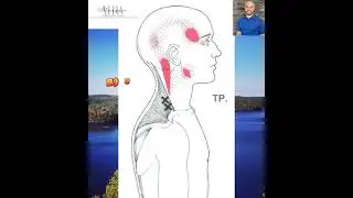 #rmt#anatomy#kinesiology#brainteaser#knowledge#popquiz#learnanatomy#study