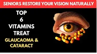 Top 6 Vitamins That Stop Cataracts & Glaucoma &mdash; Restore Clear Vision Naturally