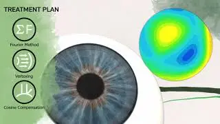 Ophthalmology Associates of the Valley | iDesign Refractive Studio