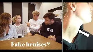 Proof that Jake Paul's assistant bruises were fake?
