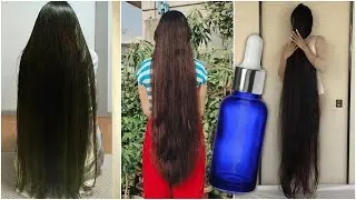 Overnight hair growth hack 💥 GROW your hairs INSANELY FAST✌️ Stop hair loss & regrow hair 🌹