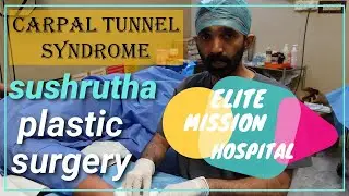 carpal tunnel syndrome treatment in thrissur sushrutha plastic surgery , elite hospital