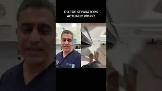 Can Toe Separators REALLY Help Your Feet? THIS Foot Doctor Says NO!