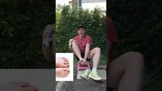 Black toenails and blisters from running, why!? #trailrunninglife #trailrunners #runningtips #run