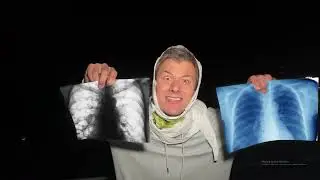 FRIENDZ   KAŻDY Z NAS NA SOR  PARODIA G O A T