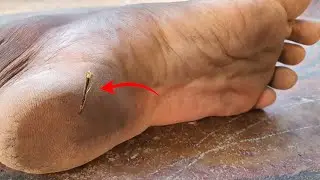 How to remove splinter or thorns from my flip flops shoes #Splinters #Thorns