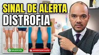 O que é Distrofia Muscular Duchenne? SINTOMAS INICIAIS E TRATAMENTO