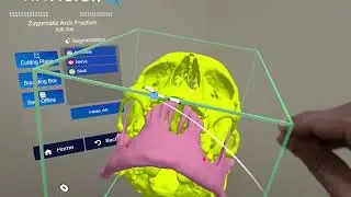 Using Virtual Reality and Augmented Reality in Surgery